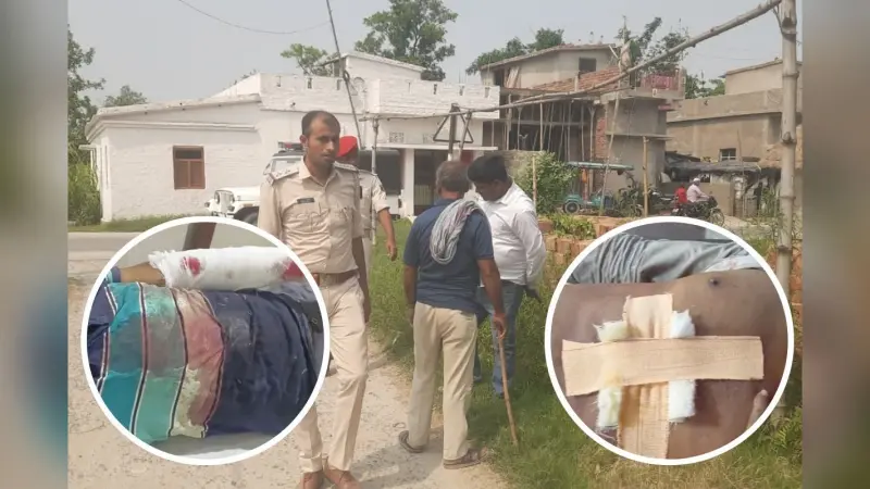 चनपटिया में खूनी संघर्ष: भूमि विवाद में चले लाठी-डंडे और धारदार हथियार, दोनों पक्षों से 12 लोग घायल